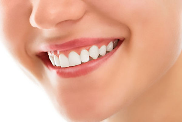 Full Mouth Dental Implants